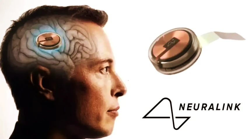 Neuralink تبدأ أولى تجاربها البشرية لزراعة شرائح الدماغ وقراءة الأفكار