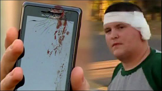 رجل يدعى بان هاتف Motorola Droid 2 انفجر فى اذنه