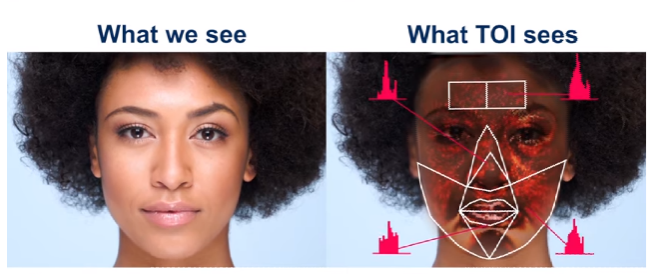 التصوير البصري عبر الجلد Transdermal Optical Imaging